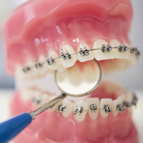 Gülü tasarm ve Ortodonti